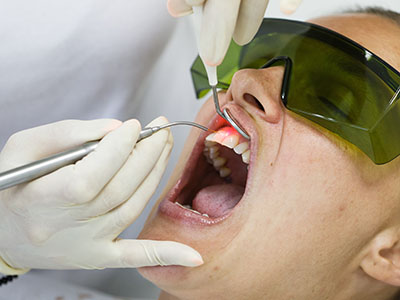 Southeastern Dental | Fluoride Treatment, E4D and Digital Impressions