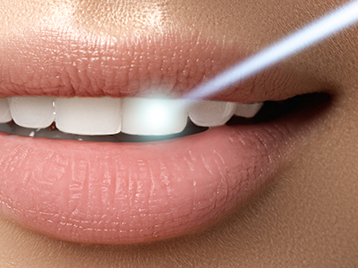 Southeastern Dental | Orthodontics, Laser Dentistry and Extractions